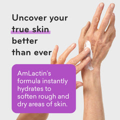 AmLactin Ultra Smoothing Intensely Hydrating Cream, Moisturizing Cream and Hand Moisturizer for Dry Skin - 4.9 Oz Tube (packaging may vary)