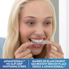 Crest 3D Whitestrips Gentle At-home Teeth Whitening Kit, 14 Treatments, Gently Removes 15 Years of Stains