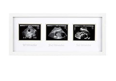 Pearhead Triple Sonogram Pregnancy Keepsake Frame, Watch Baby Grow Through all Three Trimesters - Great Gift For Expecting Parents, White