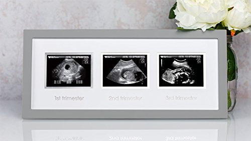 Pearhead Triple Sonogram Pregnancy Keepsake Frame, Watch Baby Grow Through all Three Trimesters - Great Gift For Expecting Parents, Grey