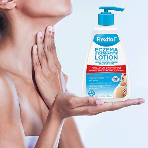 Eczema Lotion