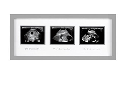 Pearhead Triple Sonogram Pregnancy Keepsake Frame, Watch Baby Grow Through all Three Trimesters - Great Gift For Expecting Parents, Grey