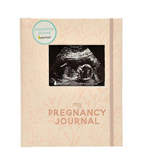 Pearhead Little Bundle of Joy Pregnancy Journal, Keepsake Pregnancy Memory Book with Sonogram Photo, First Through Third Trimester Pregnancy Milestone Tracker with Ultrasound Photo Cover, Blush Leaf