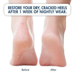 Dr. Frederick's Original Moisturizing Heel Socks for Cracked Heel Treatment - 2 Pairs - Stop Cracked Heels in Their Tracks