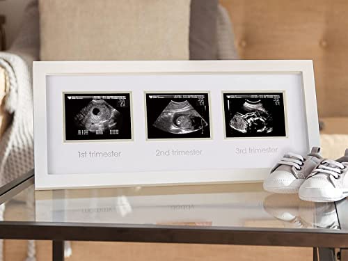 Pearhead Triple Sonogram Pregnancy Keepsake Frame, Watch Baby Grow Through all Three Trimesters - Great Gift For Expecting Parents, White