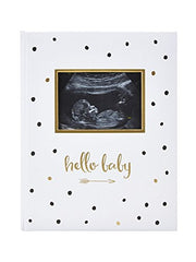 Pear Head Sonogram Baby Memory Book, Black and Gold Polka Dot (72028)