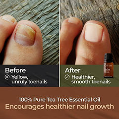 Gya Labs Pure Australian Tea Tree Oil for Skin, Hair, Face & Toenails (0.34 fl oz) - 100% Therapeutic Natural Melaleuca Tea Tree Essential Oil for Piercings, Scalp & Hair Growth