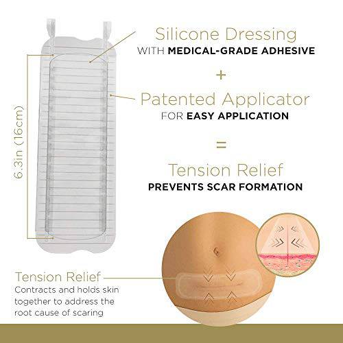 Embrace Active Scar Defense for New Scars, FDA-Cleared Silicone Scar Sheets (SIZE XL) 30 Day Supply