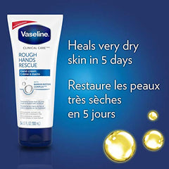 Vaseline Clinical Care hand Cream for Sensitive and Dry Hands Rough Hands Rescue Hypoallergenic 100 Ml, 100 Milliliters