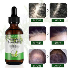 Rosemary Oil for Hair Growth,Rosemary Essential Loss Regrowth Treatment,Strengthens Hair,Nourishes Scalp,Light Weight,Non Greasy,Improves Scalp Circulation For Men And Women 2.02 Oz