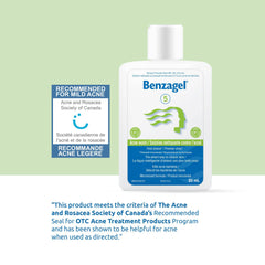 Benzagel 5% Benzoyl Peroxide Acne Wash, 85 Milliliters