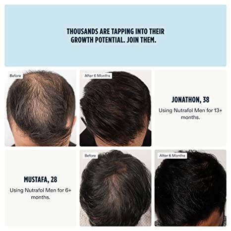 Nutrafol Men Hair Growth Supplement Clinically Effective for Visibly Thicker Hair and Scalp Coverage (1-Month Supply) - Zecoya